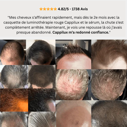 Casquette de thérapie par lumière rouge pour la repousse des cheveux