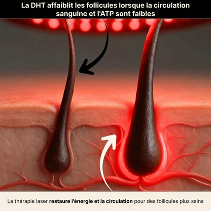 Casquette de thérapie par lumière rouge pour la repousse des cheveux